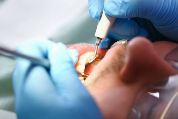 Best Emergency Care for Gum Disease in New Stanton, PA